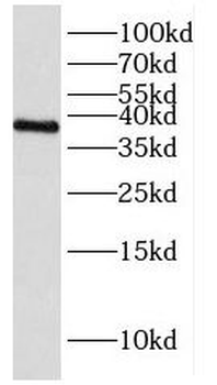 HNRNPH3 Rabbit Polyclonal Antibody