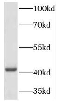HOXA2 Rabbit Polyclonal Antibody