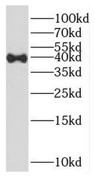 HOXD13 Rabbit Polyclonal Antibody