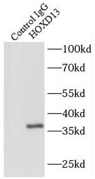 HOXD13 Rabbit Polyclonal Antibody
