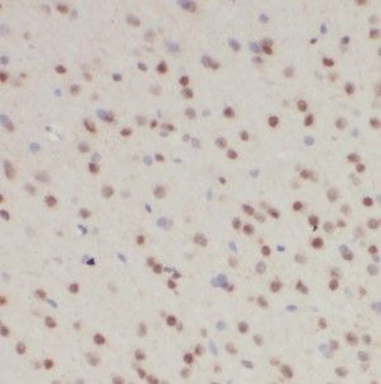 HOXD13 Rabbit Polyclonal Antibody