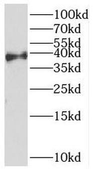 HOXD13 Rabbit Polyclonal Antibody