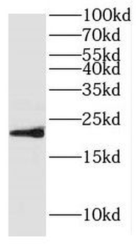 HPCAL4 Rabbit Polyclonal Antibody
