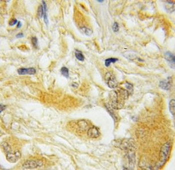 HPCAL4 Rabbit Polyclonal Antibody