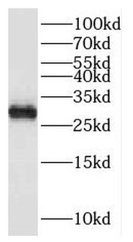 HPGDS Rabbit Polyclonal Antibody