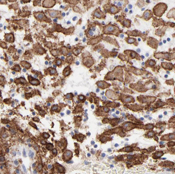 HPGDS Rabbit Polyclonal Antibody
