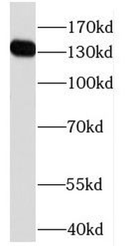 HPS5 Rabbit Polyclonal Antibody