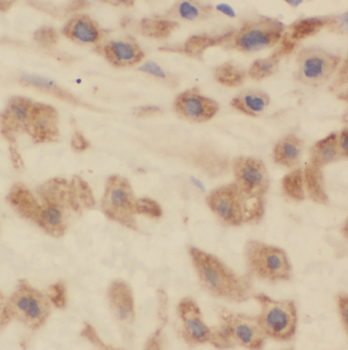HPS5 Rabbit Polyclonal Antibody