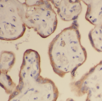 PLAAT5 Rabbit Polyclonal Antibody