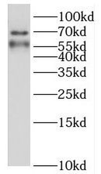 HRH2 Rabbit Polyclonal Antibody