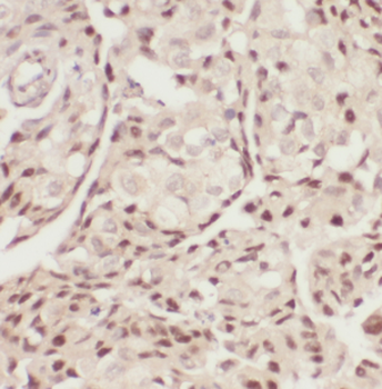 CDC73 Rabbit Polyclonal Antibody