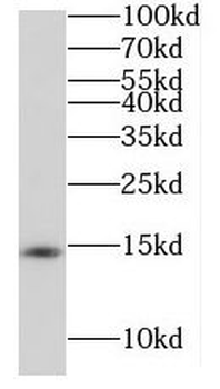 RIDA Rabbit Polyclonal Antibody