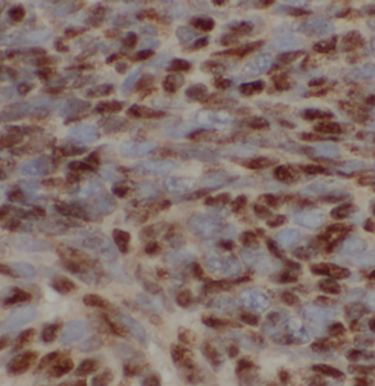 RIDA Rabbit Polyclonal Antibody