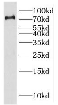 HSD17B4 Rabbit Polyclonal Antibody