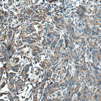 HSD17B4 Rabbit Polyclonal Antibody