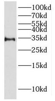 HSD17B6 Rabbit Polyclonal Antibody