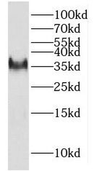 HSD17B7 Rabbit Polyclonal Antibody