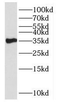 HSD17B7 Rabbit Polyclonal Antibody
