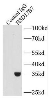 HSD17B7 Rabbit Polyclonal Antibody
