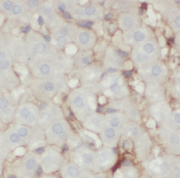 HSD17B7 Rabbit Polyclonal Antibody