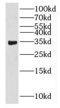 HSD17B8 Rabbit Polyclonal Antibody