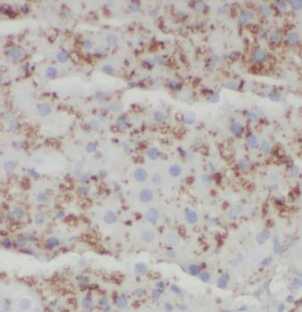 HSD17B8 Rabbit Polyclonal Antibody