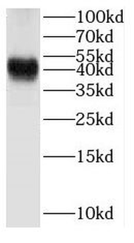 HSD3B2 Rabbit Polyclonal Antibody