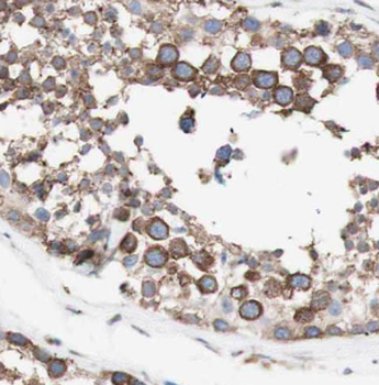 HSD3B2 Rabbit Polyclonal Antibody