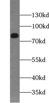 HSF1 Rabbit Polyclonal Antibody
