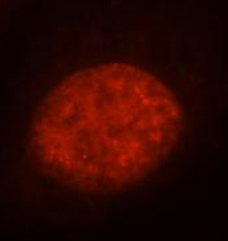 HSF1 Rabbit Polyclonal Antibody