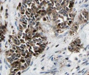 HSF1 Rabbit Polyclonal Antibody
