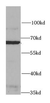 HSF2 Rabbit Polyclonal Antibody