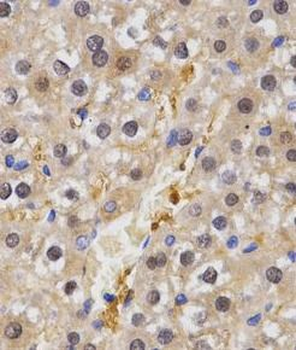 HSF2 Rabbit Polyclonal Antibody