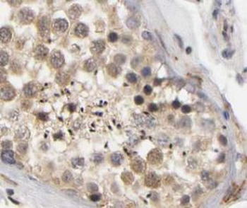 HSFY1 Rabbit Polyclonal Antibody