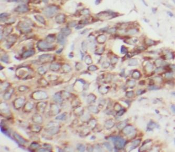 HSPB1 Rabbit Polyclonal Antibody