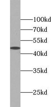 SERPINH1 Rabbit Polyclonal Antibody