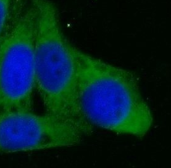 SERPINH1 Rabbit Polyclonal Antibody