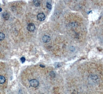 SERPINH1 Rabbit Polyclonal Antibody