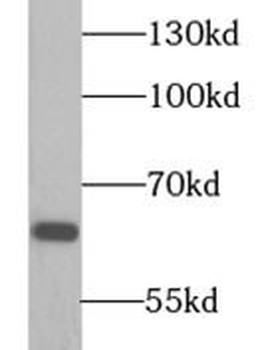HSPD1 Rabbit Polyclonal Antibody
