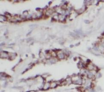 HSPD1 Rabbit Polyclonal Antibody