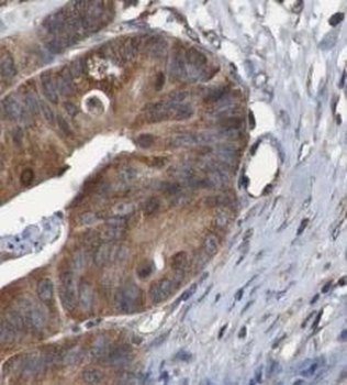 HSPD1 Mouse Monoclonal Antibody