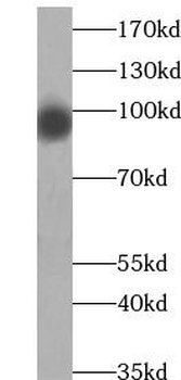 HSP90AA1 Rabbit Polyclonal Antibody