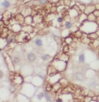 HSP90AA1 Rabbit Polyclonal Antibody