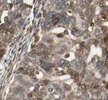 HSP90AA1 Mouse Monoclonal Antibody