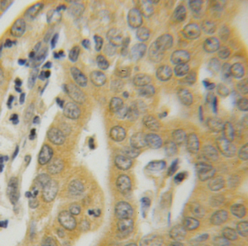 HSPA1L Rabbit Polyclonal Antibody