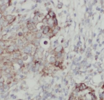 HSPA4 Rabbit Polyclonal Antibody