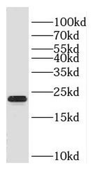 HSPB2 Rabbit Polyclonal Antibody