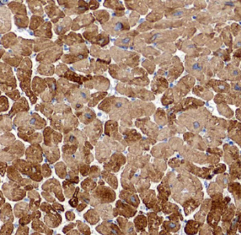 HSPB2 Rabbit Polyclonal Antibody