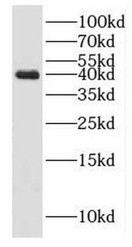 HSPBP1 Rabbit Polyclonal Antibody