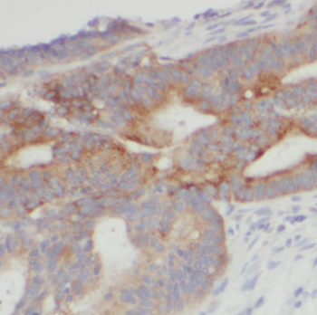 HSPBP1 Rabbit Polyclonal Antibody